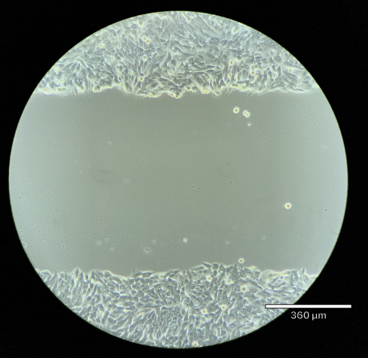 细胞 划痕实验