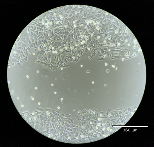 细胞 划痕实验
